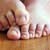 Athlete's Foot